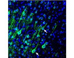 Anti-PMCA4 Antibody