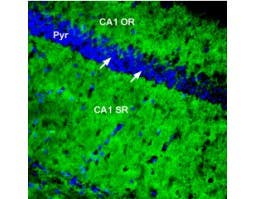 Anti-PMCA1 Antibody