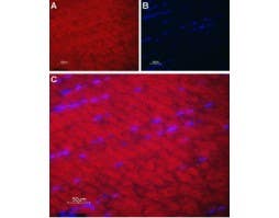 Anti-SERCA1 Antibody