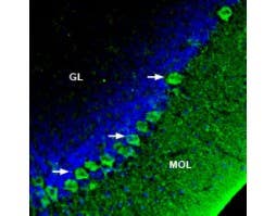 Anti-SERCA3 Antibody
