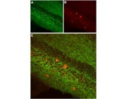Anti-Cannabinoid Receptor 1 (extracellular) Antibody