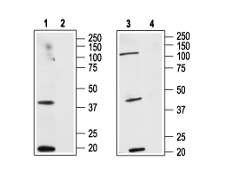 Anti-Human Cannabinoid Receptor 2 (extracellular) Antibody