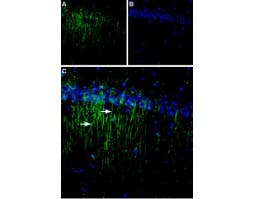 Anti-Calcium Sensing Receptor (extracellular) Antibody