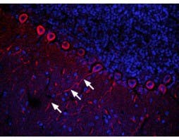 Anti-CXCR4 (extracellular) Antibody