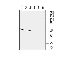Anti-Human CCR5 (extracellular) Antibody