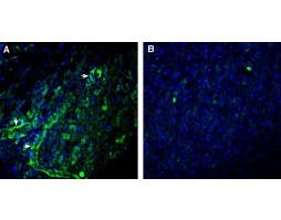 Anti-CCR7 (extracellular) Antibody