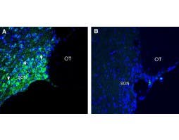 Anti-Rat CMKLR1 (extracellular) Antibody