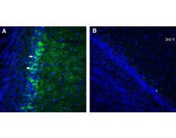 Anti-CXCR7 (ACKR3) (extracellular)-ATTO Fluor-488 Antibody