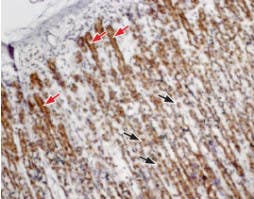 Anti-CCKBR (extracellular) Antibody