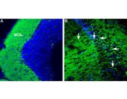 Anti-CRF1/CRHR1 (extracellular) Antibody