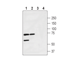 Anti-Calcitonin Receptor (extracellular) Antibody
