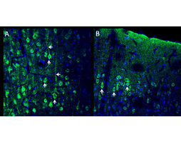 Anti-CX3CL1 (extracellular) Antibody