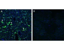 Anti-CRLR/CALCRL (extracellular) Antibody