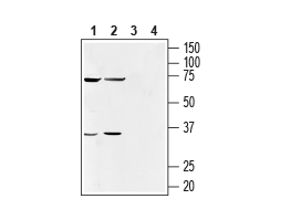 Anti-Human GPR55 (extracellular) Antibody