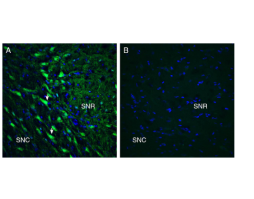 Anti-GPR55 (extracellular) Antibody