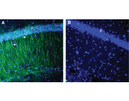 Anti-CCR2 (extracellular) Antibody