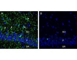 Anti-CX3CR1 (extracellular) Antibody