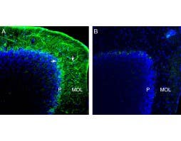 Anti-NCS1 Antibody