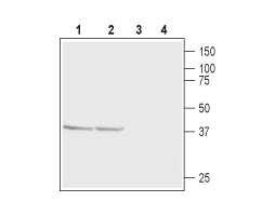Anti-CaBP1 Antibody