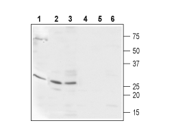 Anti-CaBP2 Antibody