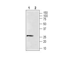 Anti-CaBP4 Antibody