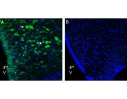 Anti-Nucleobindin-2/Nesfatin-1 Antibody