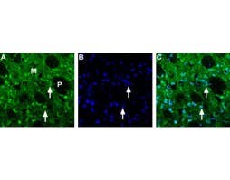 Anti-Choline Transporter (SLC5A7) (extracellular) Antibody