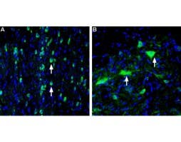 Anti-Vesicular Acetylcholine Transporter (VAChT) Antibody