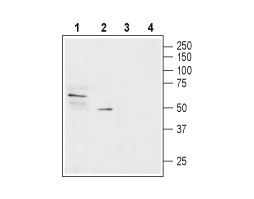 Anti-SLC22A1 Antibody