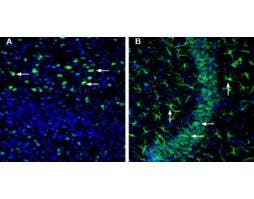 Anti-SLC22A3 (extracellular) Antibody
