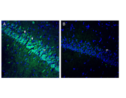Anti-OCTN1/SLC22A4 Antibody