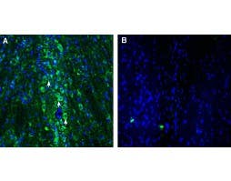 Anti-SLC22A2 (OCT2) Antibody