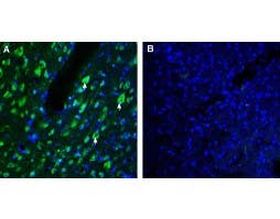 Anti-AXL (extracellular) Antibody