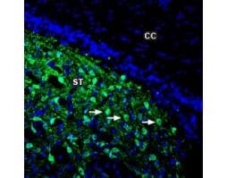 Anti-DARPP32 Antibody