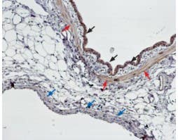 Anti-Endothelin Receptor B Antibody
