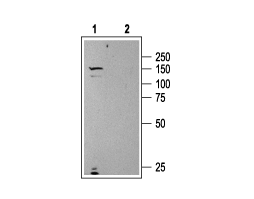 Anti-Urotensin II Receptor Antibody