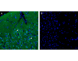 Anti-Endothelin Receptor A (extracellular) Antibody