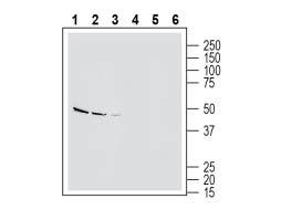 Anti-Endothelin Receptor B (extracellular) Antibody