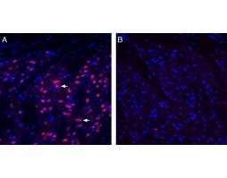 Anti-EphA1 (extracellular) Antibody
