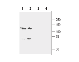 Anti-EphB1 (extracellular) Antibody