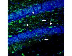 Anti-Ephrin-A2 (extracellular) Antibody