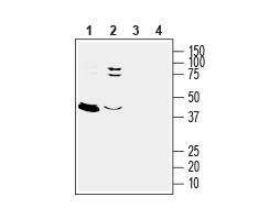 Anti-GPER1/GPR30 (extracellular) Antibody