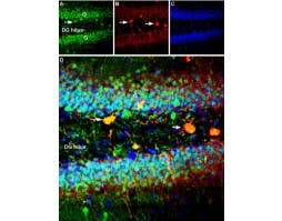 Anti-GPER (GPR30) Antibody