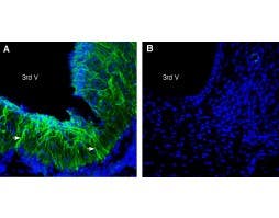 Anti-FSHR (extracellular) Antibody