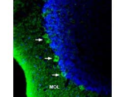 Anti-GPR40/FFAR1 (extracellular) Antibody