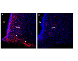 Anti-GPR120/FFAR4 (extracellular) Antibody