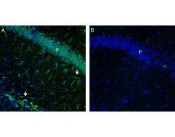 Anti-GPR43/FFAR2 Antibody