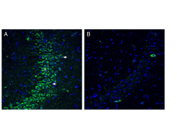Anti-SLC19A1/RFC1 (extracellular) Antibody