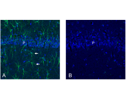Anti-SLC19A3 Antibody