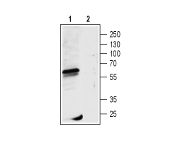 Anti-GABA(A) ρ1 Receptor (GABRR1) (extracellular) Antibody